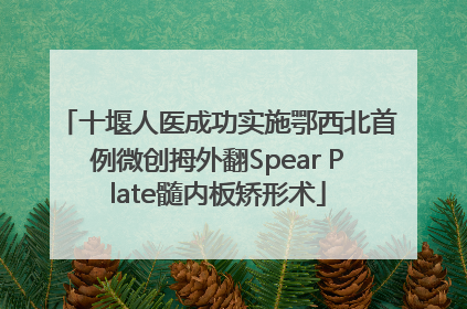 十堰人医成功实施鄂西北首例微创拇外翻Spear Plate髓内板矫形术